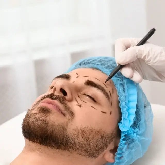 How Chemical Peels Improve Periocular Skin