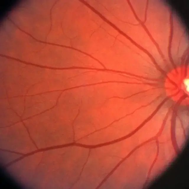 OCT diagnostic imaging technology