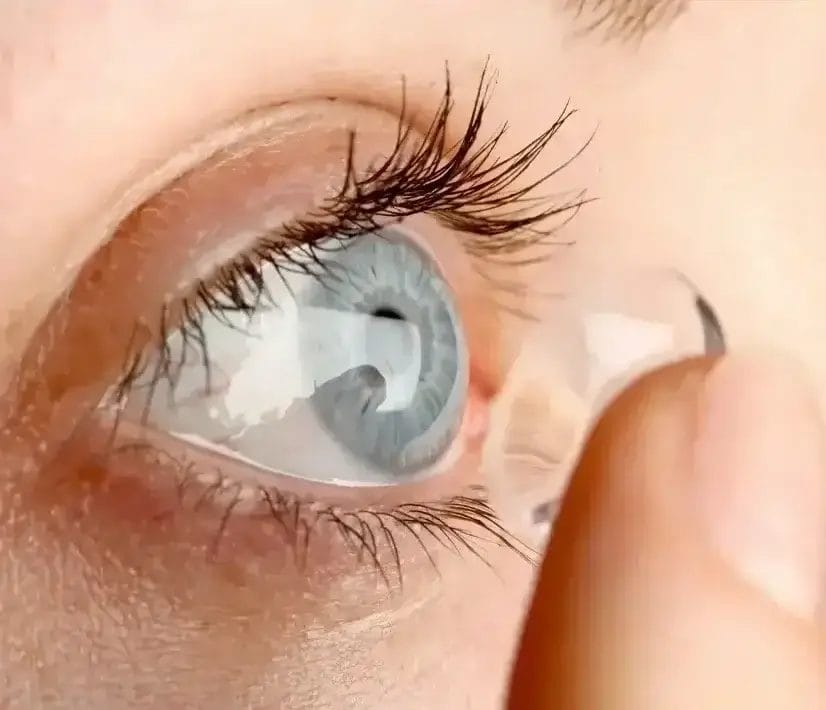 Specialty contact lens fitting at Greenwich Ophthalmology
